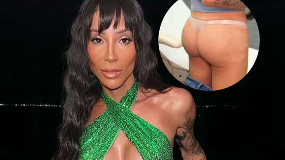 Maya Massafera decide aumentar próteses de silicone no bumbum e desiste do PMMA. Veja 5 principais riscos!