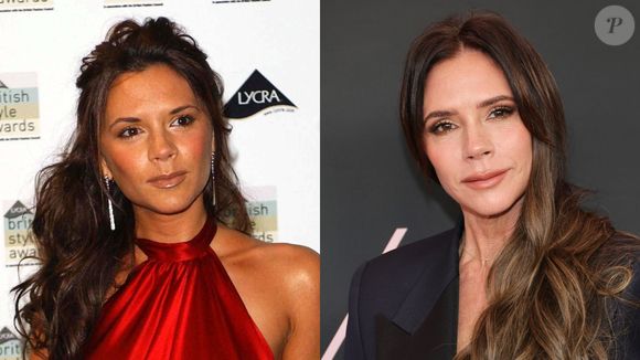 Victoria Beckham também aposta no botox para segurar a pele e mantê-la mais firme