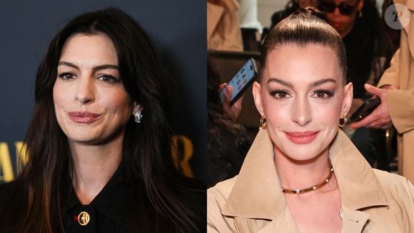 Comparação entre o rosto de Anne Hathaway: assim estava a atriz em outubro e está agora