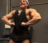 A discussão sobre os bastidores do fisiculturismo aumentou após a morte de Gabriel Ganley. Segundo a endocrinologista Dra. Tassiane Alvarenga, a insulina usada sem acompanhamento médico pode causar hipoglicemia severa, condição capaz de evoluir rapidamente para convulsões e coma
