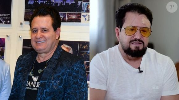 Antes e depois de Marrone: dupla de Bruno, cantor ficou irreconhecível após sofrer acidente no palco; antes disso, já havia feito procedimentos estéticos
