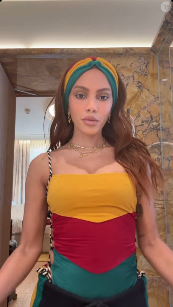 Novo rosto de Anitta levantou rumores sobre novos procedimentos estéticos feitos pela cantora