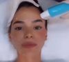 Bruna Marquezine, que faz aniversário nesta segunda (4), é adepta do Ultraformer MPT, um ultrassom de alta tecnologia que virou a tal da "poupança de colágeno"
