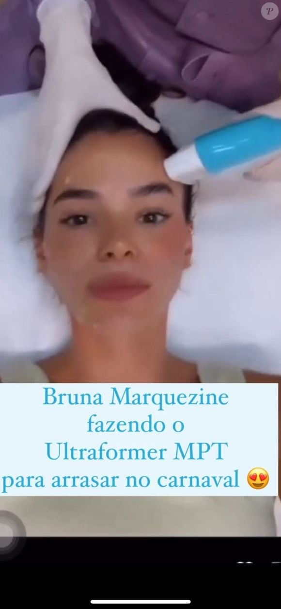 Bruna Marquezine, que faz aniversário nesta segunda (4), é adepta do Ultraformer MPT, um ultrassom de alta tecnologia que virou a tal da "poupança de colágeno"