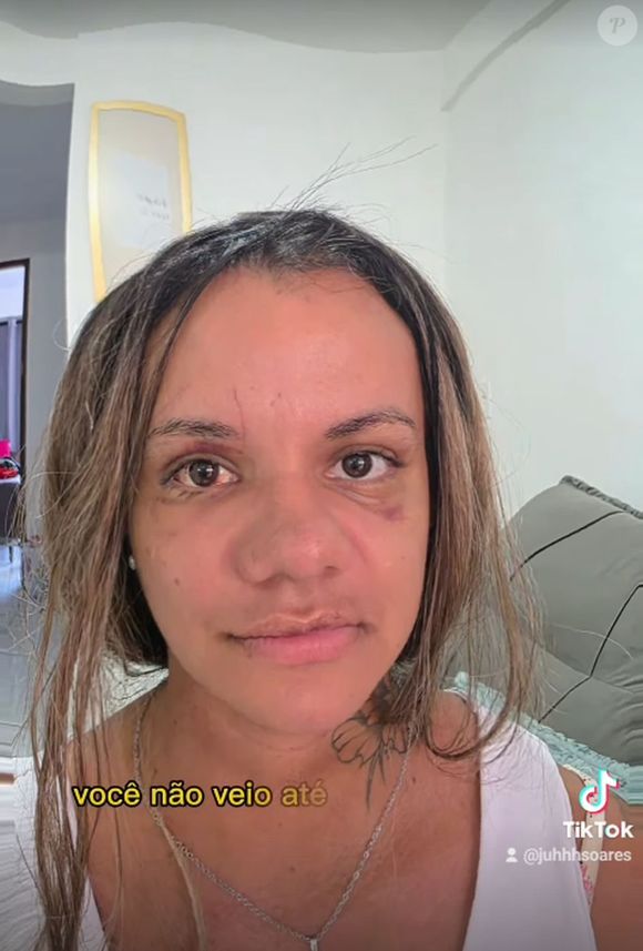Juliana Soares vem se recuperando física e emocionalmente da violência que sofreu do ex