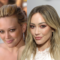 Em 2004, Hilary Duff era a Cinderela moderna que conquistou uma geração; hoje, aos 39 anos, atriz revela uso de sêmen de salmão e microagulhamento na pele do rosto; médico detalha: ‘O melhor resultado não é aquele que rejuvenesce, e sim aquele em que a identidade foi preservada’