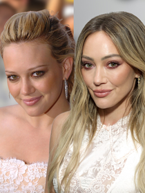 Em 2004, Hilary Duff era a Cinderela moderna que conquistou uma geração; hoje, aos 39 anos, atriz revela uso de sêmen de salmão e microagulhamento na pele do rosto; médico detalha: ‘O melhor resultado não é aquele que rejuvenesce, e sim aquele em que a identidade foi preservada’