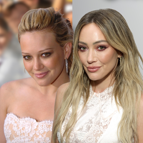 Em 2004, Hilary Duff era a Cinderela moderna que conquistou uma geração; hoje, aos 39 anos, atriz revela uso de sêmen de salmão e microagulhamento na pele do rosto; médico detalha: ‘O melhor resultado não é aquele que rejuvenesce, e sim aquele em que a identidade foi preservada’