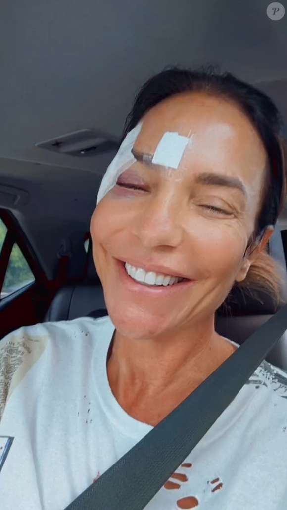 Ivete Sangalo revelou que, por conta da desidratação, foi acometida por uma síncope vasovagal