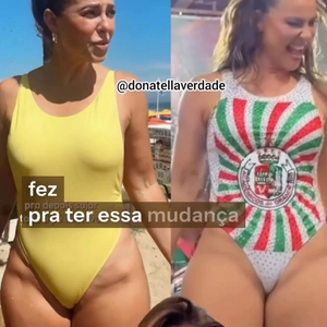 A cirurgiã comparou duas fotos de Paolla de maiô: uma na praia, à luz do dia, e outra mais recente, da aparição da ex-rainha de bateria na quadra da Grande Rio