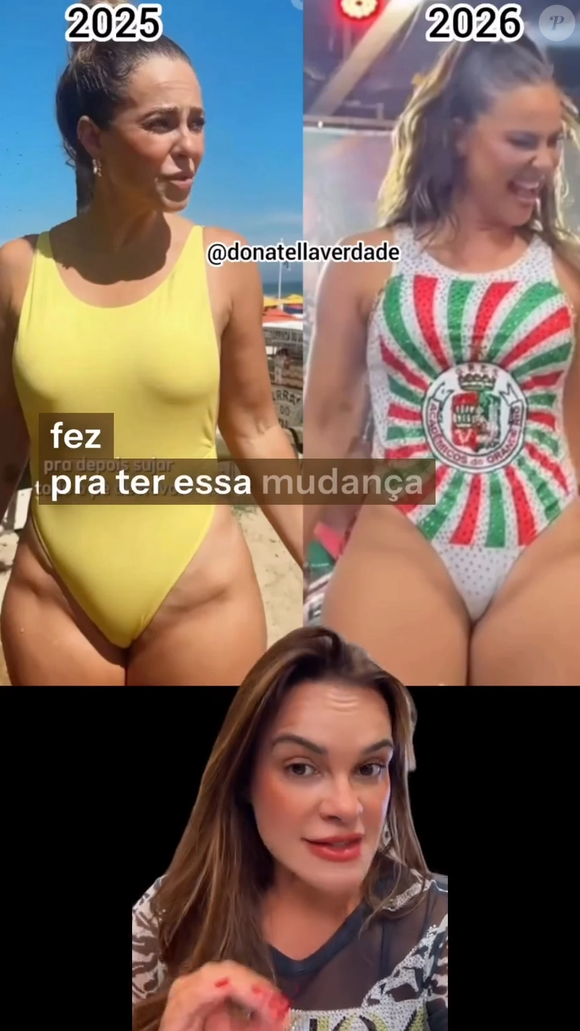 A cirurgiã comparou duas fotos de Paolla de maiô: uma na praia, à luz do dia, e outra mais recente, da aparição da ex-rainha de bateria na quadra da Grande Rio