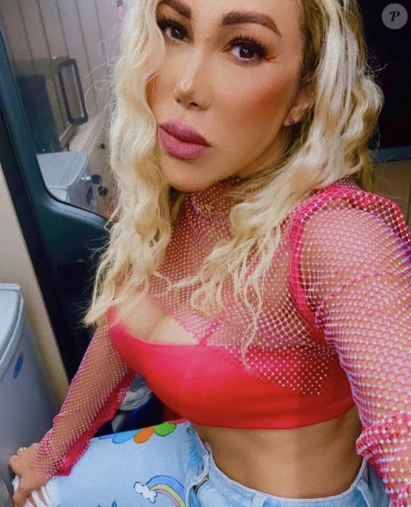 Taty Girl fez preenchimentos em áreas estratégicas do rosto, além de ter colocado botox