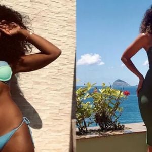 Bárbara Reis revelou diagnóstico de lipedema e gerou debate nas redes sociais