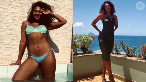 Bárbara Reis revelou diagnóstico de lipedema e gerou debate nas redes sociais