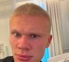 Erling Haaland de cabelo curto: atacante norueguês abandonou os longos fios loiros e surpreendeu os seguidores com o novo visual antes da temporada do Manchester City