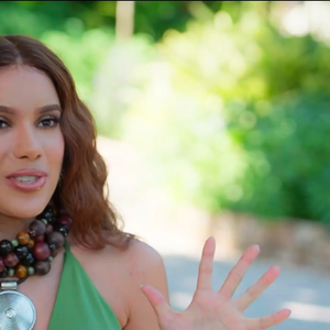 Novo visual de Anitta reacende debate sobre técnicas modernas: 'Hoje não é necessário raspar o cabelo', destaca Vlassios Marangos ao falar sobre evolução do transplante