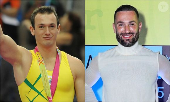 Antes e depois de Diego Hypólito: o ginasta e ex-BBB também mudou seu visual com transplante capilar