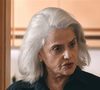 O cabeleireiro Eduardo Sánchez explicou à Vanity Fair España que “um cabelo desidratado é um cabelo poroso”. Essa característica ajuda a entender por que fios recém-penteados e alinhados podem ficar cheios de cabelinhos arrepiados e rebeldes quando entram em contato com a umidade