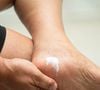 Creme com ureia, meia e lixa suave: médica ensina rotina para recuperar calcanhares