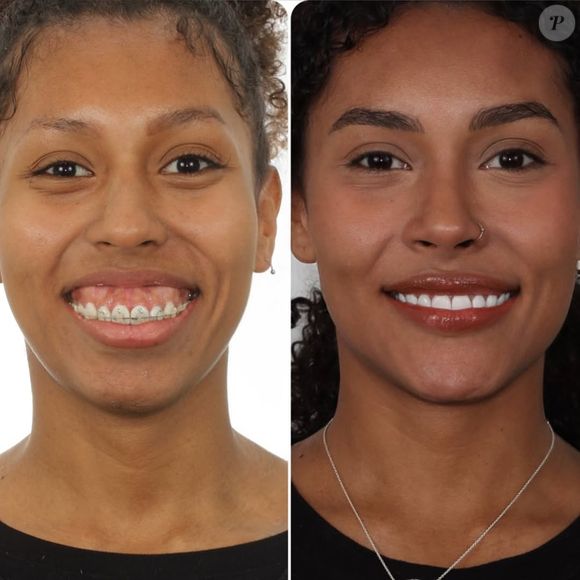 Antes e depois de Giovanna Jacobina chocou a web e rendeu muitos elogios tanto para a influenciadora quanto para a médica