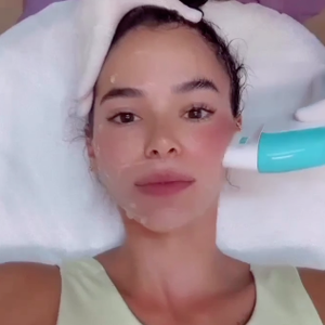 Bruna Marquezine é adepta do bioestimulador de colágeno em seu rosto e corpo para ficar com a pele lisinha