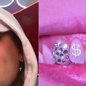 Gloria Groove também já exibiu um acessório brilhante no dente, fazendo parte do grupo de famosas que ajudaram a popularizar esse tipo de adereço como elemento de beleza e estilo