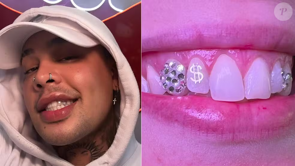 Gloria Groove também já exibiu um acessório brilhante no dente, fazendo parte do grupo de famosas que ajudaram a popularizar esse tipo de adereço como elemento de beleza e estilo
