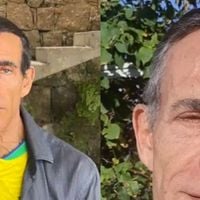 Antes e depois de Mário Gomes: ator de 'A Favorita' faz harmonização facial aos 72 anos e 'rejuvenesce 20'. Resultado impressiona!