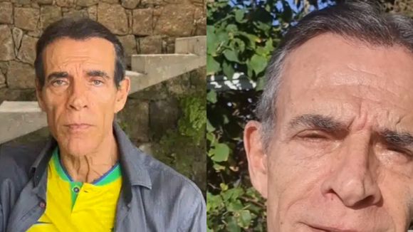 Antes e depois de Mário Gomes: ator de 'A Favorita' faz harmonização facial aos 72 anos e 'rejuvenesce 20'. Resultado impressiona!
