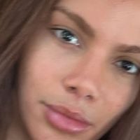 ‘Se fiz e não gostei, faço outra’: há quase 10 anos, Anitta chocou ao comparar plásticas a pintar o cabelo