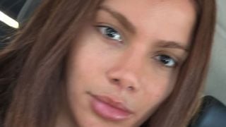 ‘Se fiz e não gostei, faço outra’: há quase 10 anos, Anitta chocou ao comparar plásticas a pintar o cabelo