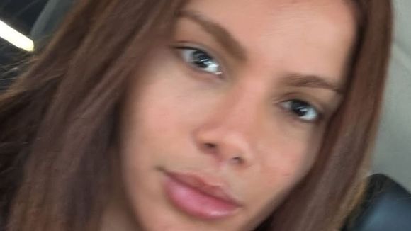 ‘Se fiz e não gostei, faço outra’: há quase 10 anos, Anitta chocou ao comparar plásticas a pintar o cabelo