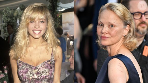 Pamela Anderson deixou os americanos loucos com sua beleza em 'S.O.S. Malibu'. Ainda engajada em sua carreira, há quem diga que ela é uma das belezas naturais mais potentes da atualidade