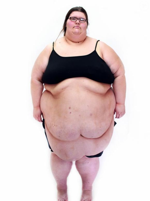 Megan tinha tinha pressão alta, dores constantes e dificuldade respiratória, além de problemas no coração e pulmão