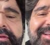 Como está o cantor Fabiano, dupla de Cesar Menotti, após grave acidente de carro?