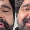 Como está o cantor Fabiano, irmão de César Menotti, após grave acidente? Cantor grava 1º vídeo após susto em estrada: 'Grande livramento'