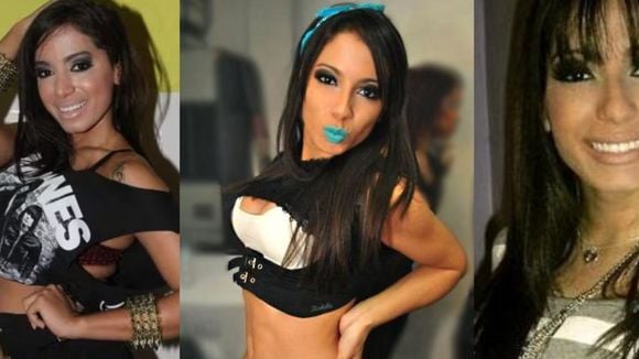 Poucos sabem, mas Anitta já havia feito duas plásticas antes de explodir com ‘Show das Poderosas’: 'Sempre fui ansiosa'