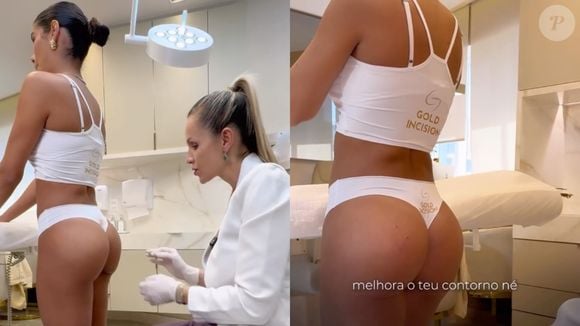 Munik Nunes recorreu à harmonização glútea para recuperar a firmeza e curvas de seu bumbum após a gravidez