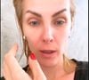 Ana Hickmann alega fraude e afirma que não contratou o empréstimo milionário.