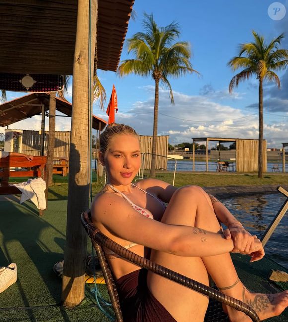 Virgínia Fonseca revelou, nesta quarta-feira (22), que voltou a tratar alopecia areata