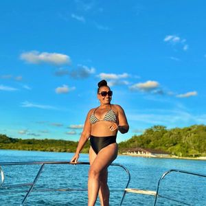 Assim como aumentam os riscos, cirurgias como as de Solange Couto também requerem um pós-operatório delicado e intenso