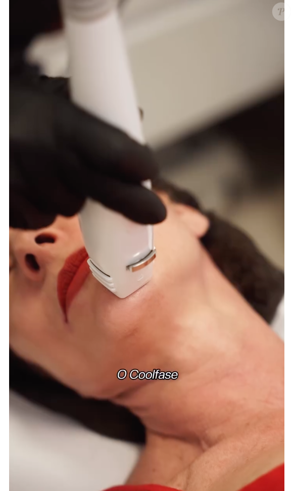Um dos procedimentos que Ana Paula Padrão faz é o Coolfase, uma tecnologia coreana que promove uma beleza mais natural