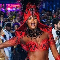 Barriga zero flacidez e adeus à diástase: Iza 'turbinou' o corpo com 2 procedimentos estéticos de alta tecnologia; 'Melhoram o tônus da parede abdominal', revela dermatologista da cantora