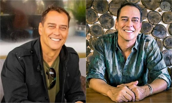 Ator da novela 'Terra Nostra', Marcello Antony se submeteu a transplante capilar