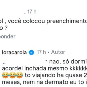 Atriz ironiza críticas, descarta procedimentos e crava: 'acordei inchada mesmo'