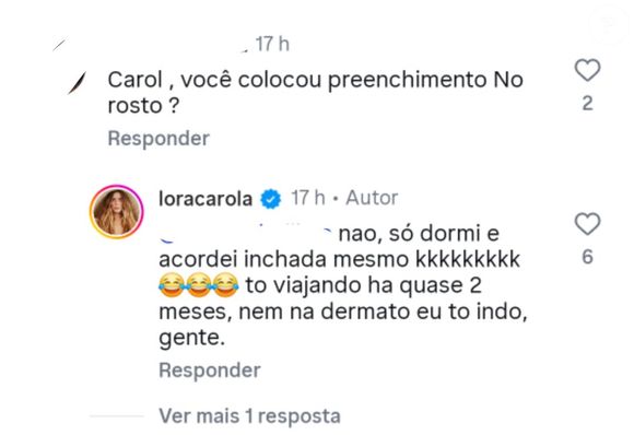 Atriz ironiza críticas, descarta procedimentos e crava: 'acordei inchada mesmo'