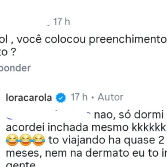 Atriz ironiza críticas, descarta procedimentos e crava: 'acordei inchada mesmo'