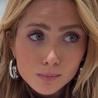 Que susto! Jade Picon mostra corpo com hematomas após acidente em Los Angeles: 'Esticou os dois braços pra frente'