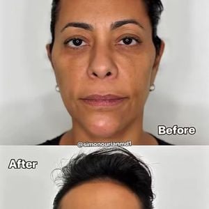 Samantha Schmütz apareceu muito mais jovem no 'antes e depois' publicado pelo médico de Kim Kardashian