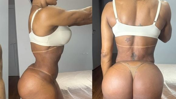 Gracyanne Barbosa ganha 20 kg em apenas três dias e choca a web; musa fitness explica mudança brusca na balança após cirurgia